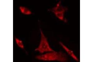 ABIN6275020 staining Hela cells by IF/ICC. (CLASP1 抗体  (Internal Region))