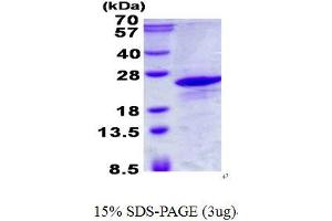 Image no. 1 for Immature Colon Carcinoma Transcript 1 (ICT1) protein (His tag) (ABIN1098472) (ICT1 Protein (His tag))
