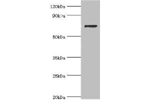 Western blot All lanes: SLC25A13 antibody at 3 μg/mL + HepG2 whole cell lysate Secondary Goat polyclonal to rabbit IgG at 1/10000 dilution Predicted band size: 74 kDa Observed band size: 74 kDa