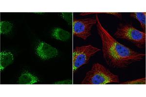 ICC/IF Image Fibrinogen gamma antibody detects Fibrinogen gamma protein at cytoplasm by immunofluorescent analysis. (FGG 抗体)