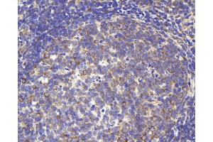 Immunohistochemistry analysis of paraffin-embedded rat lymph using CD284 Polyclonal Antibody at dilution of 1:1000. (TLR4 抗体)