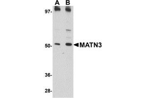 Western Blotting (WB) image for anti-Matrilin 3 (MATN3) (C-Term) antibody (ABIN1030509) (Matrilin 3 抗体  (C-Term))