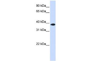 WB Suggested Anti-GPD1L Antibody Titration: 0. (GPD1L 抗体  (Middle Region))