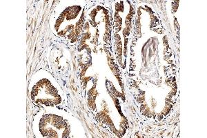 IHC analysis of BCKDHA using anti-BCKDHA antibody (ABIN7601223).