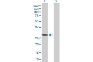 Western Blot analysis of HLA-DRB3 expression in transfected 293T cell line by HLA-DRB3 MaxPab polyclonal antibody. (HLA-DRB3 抗体  (AA 1-266))