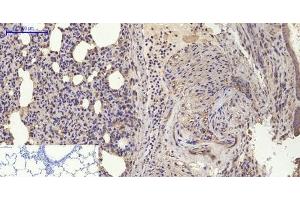 Immunohistochemistry of paraffin-embedded Rat lung tissue using BMP2 Polyclonal Antibody at dilution of 1:200. (BMP2 抗体)