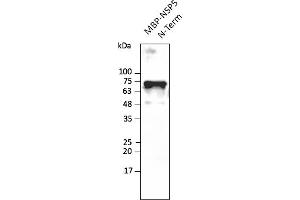 Western Blotting (WB) image for anti-SARS-CoV-2 3C-Like Proteinase (NSP5) (3CL-PRO, M-Pro) (N-Term) antibody (ABIN7273000) (SARS-CoV-2 NSP5 (3CL-Pro) 抗体  (N-Term))
