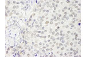 Immunohistochemistry (IHC) image for anti-GATA Zinc Finger Domain Containing 2B (GATAD2B) (AA 50-100) antibody (ABIN7448709)