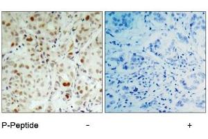 Image no. 2 for anti-Retinoblastoma 1 (RB1) (pSer807) antibody (ABIN196840) (Retinoblastoma 1 抗体  (pSer807))
