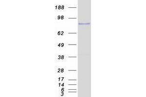 Validation with Western Blot