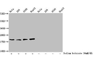 Western Blot Detected samples: Hela whole cell lysate, 293 whole cell lysate, A549 whole cell lysate, HepG2 whole cell lysate, Untreated (-) or treated (+) with 30 mM sodium butyrate for 4h All lanes: HIST1H1C antibody at 2. (HIST1H1C 抗体  (acLys84))