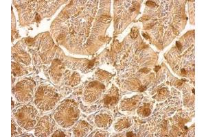 Immunohistochemistry (IHC) image for anti-Heat Shock Protein 90kDa alpha (Cytosolic), Class B Member 1 (HSP90AB1) (Internal Region) antibody (ABIN2855037)
