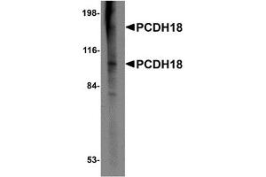 Western Blotting (WB) image for anti-Protocadherin 18 (PCDH18) (N-Term) antibody (ABIN1031506) (PCDH18 抗体  (N-Term))