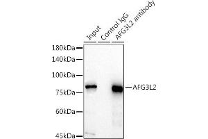 Immunoprecipitation analysis of 300 μg extracts of HeLa cells using 3 μg L2 antibody (ABIN7265513). (AFG3L2 抗体  (AA 538-797))