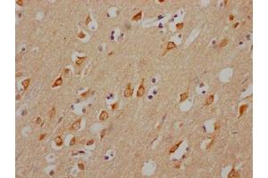 IHC image of ABIN7127632 diluted at 1:100 and staining in paraffin-embedded human brain tissue performed on a Leica BondTM system. (Recombinant CHRM3 抗体)