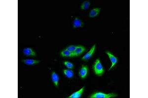Immunofluorescent analysis of A549 cells using ABIN7158866 at dilution of 1:100 and Alexa Fluor 488-congugated AffiniPure Goat Anti-Rabbit IgG(H+L) (M-CSF/CSF1 抗体  (AA 33-554))