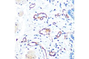 Immunohistochemistry of paraffin-embedded human esophageal using von Willebrand factor (VWF) Rabbit mAb (ABIN6129836, ABIN6144889, ABIN6144890 and ABIN7101425) at dilution of 1:100 (40x lens). (VWF 抗体)