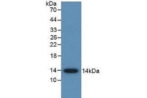 Western blot analysis of recombinant Human AMH. (AMH 抗体  (AA 453-560))