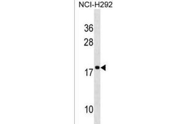 RPS17L 抗体  (AA 77-103)