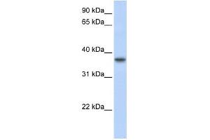 TMEM173 antibody used at 1 ug/ml to detect target protein. (STING/TMEM173 抗体  (Middle Region))