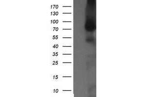Image no. 1 for anti-NIMA (Never In Mitosis Gene A)-Related Kinase 11 (NEK11) antibody (ABIN1499682) (NEK11 抗体)