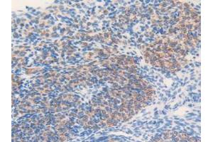 IHC-P analysis of Mouse Ovary Tissue, with DAB staining.