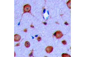 Immunohistochemical analysis of GLP-1 Receptor staining in human brain formalin fixed paraffin embedded tissue section. (GLP1R 抗体  (Center))