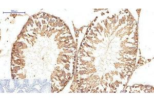 Immunohistochemistry of paraffin-embedded Rat testis tissue using ATG5 Monoclonal Antibody at dilution of 1:200. (ATG5 抗体)