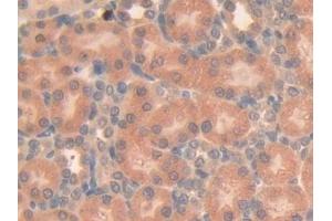 Immunohistochemistry (IHC) image for anti-Sema Domain, Immunoglobulin Domain (Ig), Short Basic Domain, Secreted, (Semaphorin) 3A (SEMA3A) (AA 31-150) antibody (ABIN7430105)