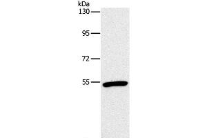 Western Blot analysis of Mouse heart tissue using OXTR Polyclonal Antibody at dilution of 1:866 (Oxytocin Receptor 抗体)