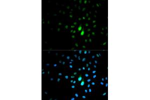 Immunofluorescence analysis of MCF-7 cells using PIN1 antibody. (PIN1 抗体)