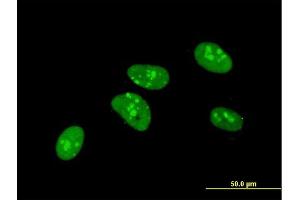 Immunofluorescence of monoclonal antibody to PKNOX1 on HeLa cell. (PKNOX1 抗体  (AA 2-100))