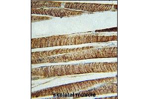 Immunohistochemical analysis of paraffin-embedded H. (beta Actin 抗体)