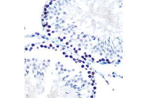 Immunohistochemistry of paraffin-embedded rat testis using mSin3A Rabbit mAb (ABIN7270318) at dilution of 1:100 (40x lens). (SIN3A 抗体)