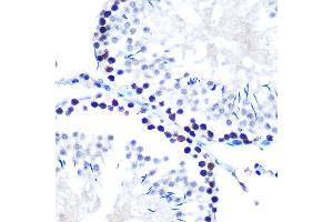Immunohistochemistry of paraffin-embedded rat testis using mSin3A Rabbit mAb (ABIN7270318) at dilution of 1:100 (40x lens).