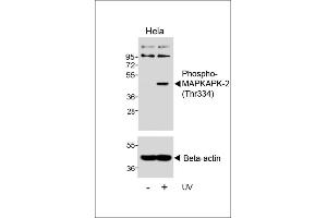 Western blot analysis of lysates from Hela cell line, untreated or treated with UV, 30 min, using 456580101 (ABIN6241065 and ABIN6578952) (upper) or Beta-actin (lower). (MAPKAP Kinase 2 抗体  (pThr334))