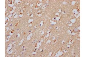 IHC image of ABIN7127506 diluted at 1:100 and staining in paraffin-embedded human brain tissue performed on a Leica BondTM system. (Recombinant GABRA5 抗体)