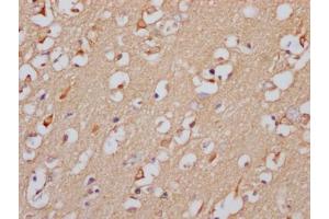 IHC image of ABIN7127506 diluted at 1:100 and staining in paraffin-embedded human brain tissue performed on a Leica BondTM system.