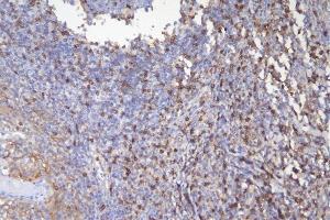 IHC analysis of CD5 using anti-CD5 antibody (ABIN7600913).