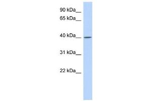 C11ORF65 antibody used at 1 ug/ml to detect target protein. (C11orf65 抗体  (N-Term))