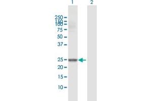 Western Blot analysis of GSTM4 expression in transfected 293T cell line by GSTM4 MaxPab polyclonal antibody. (GSTM4 抗体  (AA 1-218))
