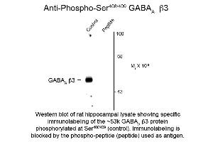 Western Blotting (WB) image for anti-gamma-aminobutyric Acid (GABA) A Receptor, beta 3 (GABRB3) (pSer408), (pSer409) antibody (ABIN6658226)