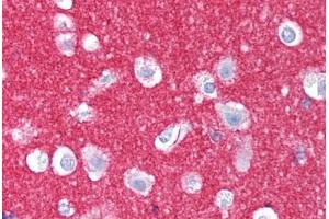 Human Brain, Cortex (formalin-fixed, paraffin-embedded) stained with NCAM1 antibody ABIN239829 at 10 ug/ml followed by biotinylated anti-mouse IgG secondary antibody ABIN481714, alkaline phosphatase-streptavidin and chromogen. (CD56 抗体)