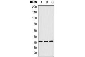 Western blot analysis of CRK expression in HeLa (A), K562 (B), NIH3T3 (C) whole cell lysates. (Crk 抗体  (Center))