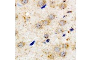 Immunohistochemical analysis of PACAP-R1 staining in human brain formalin fixed paraffin embedded tissue section. (ADCYAP1R1 抗体)