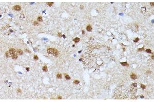 Immunohistochemistry of paraffin-embedded Mouse brain using KIAA1429 Polyclonal Antibody at dilution of 1:100 (40x lens). (VIRMA/KIAA1429 抗体)