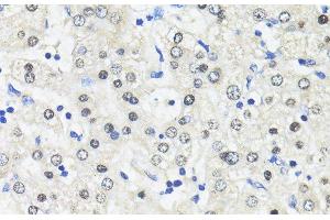Immunohistochemistry of paraffin-embedded Human liver using TRIM27 Polyclonal Antibody at dilution of 1:100 (40x lens). (TRIM27 抗体)