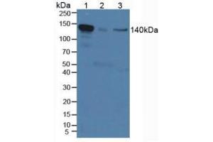 Western blot analysis of (1) Mouse Serum, (2) Mouse Placenta Tissue and (3) Human HeLa cells. (IL12RB2 抗体  (AA 285-441))