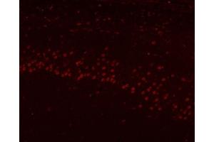 IF analysis of HnRNP H/HNRNPH1 using anti-HnRNP H/HNRNPH1 antibody (ABIN4886623). (HNRNPH1 抗体  (N-Term))
