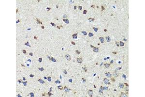 Immunohistochemistry of paraffin-embedded Mouse brain using CCDC124 Polyclonal Antibody at dilution of 1:100 (40x lens). (CCDC124 抗体)